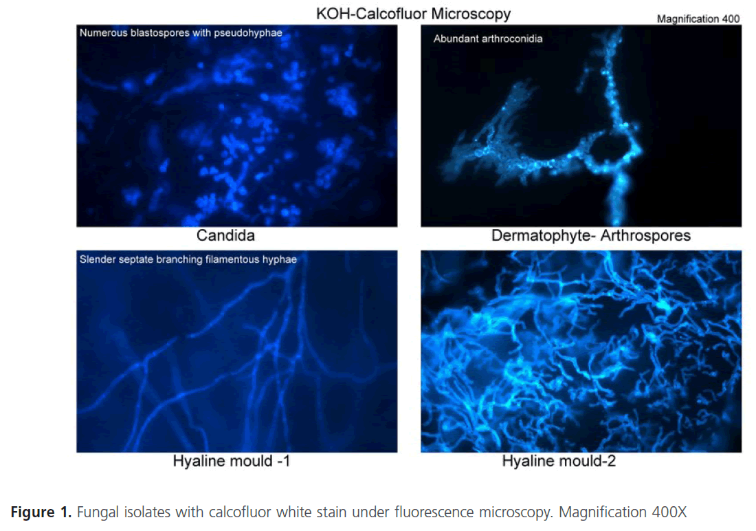 Dermatophytes Under Microscope